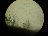 Penicillium vulpinum image