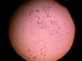 Ustilago maydis image