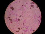 Ustilago maydis image