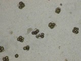 Tuber melanosporum image