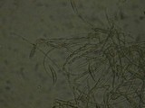 Fusarium equiseti image