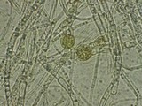 Fusarium equiseti image