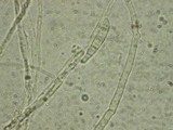Fusarium equiseti image