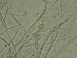 Fusarium equiseti image