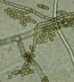 Cladosporium sphaerospermum image