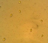 Atheniella leptophylla image
