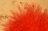 Atheniella leptophylla image