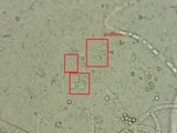 Penicillium roqueforti image