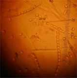 Hypocrea nybergiana image
