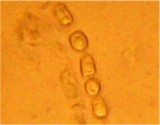 Hypocrea nybergiana image
