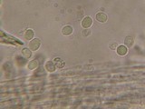 Mucronella pendula image
