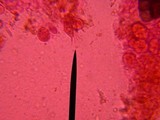Basidiodendron caesiocinereum image