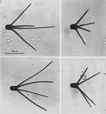 Tetraplosphaeria tetraploa image