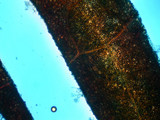 Bremia lactucae image