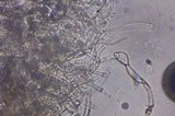 Echinoderma carinii image
