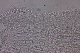 Echinoderma carinii image