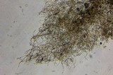 Echinoderma carinii image