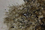 Echinoderma carinii image
