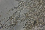 Echinoderma carinii image