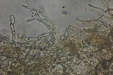 Echinoderma carinii image