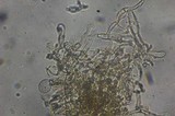 Echinoderma carinii image