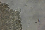 Echinoderma carinii image