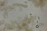Echinoderma carinii image