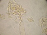 Botryobasidium longisporum image