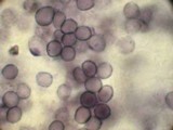 Boidinia propinqua image