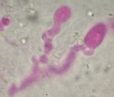 Gloeodontia subasperispora image