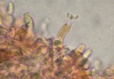 Gloeodontia subasperispora image