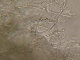 Schizopora paradoxa image