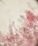 Amphinema byssoides image