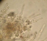Amphinema byssoides image