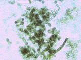 Chorioactis geaster image