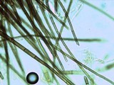 Chorioactis geaster image