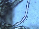 Chorioactis geaster image