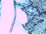 Chorioactis geaster image