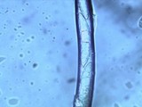 Chorioactis geaster image