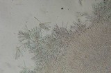 Chlorociboria aeruginascens image