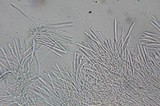 Chlorociboria aeruginascens image