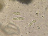 Oedohysterium insidens image