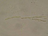 Hypocrea moravica image