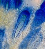 Ochrolechia subplicans image