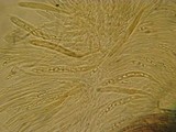 Lachnum corticale image