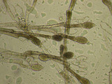 Allomyces macrogynus image