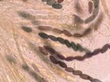 Neohypodiscus cerebrinus image