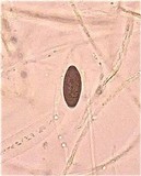 Neohypodiscus cerebrinus image