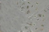 Lepiota trichroma image