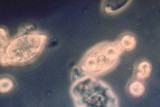 Phytophthora infestans image